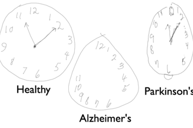Coupled with a digital pen, new models from the MIT Computer Science and Artificial Intelligence Lab can help detect dementia and other cognitive disorders earlier than ever before.