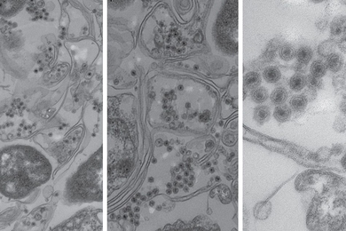 Electron microscope images of marine bacteria infected with the non-tailed viruses studied in this research. The bacterial cell walls are seen as long double lines, and the viruses are the small round objects with dark centers.
