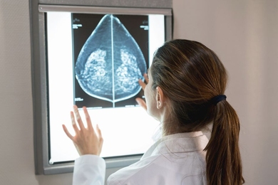 MIT and MGH researchers have developed an automated deep-learning model, currently being used on real patients, that identifies dense breast tissue — a risk factor for breast cancer — in mammograms as reliably as expert radiologists.