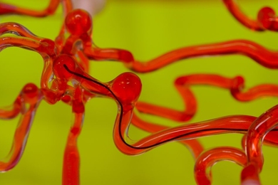 MIT engineers have developed robotic thread (in black) that can be steered magnetically and is small enough to work through narrow spaces such as the vasculature of the human brain. The researchers envision the technology may be used in the future to clear blockages in patients with stroke and aneurysms.