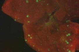 Small secondary tumors (shown in green) formed in the lungs of mice after Li Ma, a postdoctoral researcher at the Whitehead Institue for Biomedical Research, inserted human breast cancer cells into their mammary fat pads. The cancer cells, which normally don't metastasize, acquired the ability to move and invade when Ma boosted the level of a single microRNA.