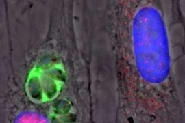 This image shows two human skin cells. The cell at left is infected with the Toxoplasma gondii parasite expressing type II GRA15, which can be seen in green. The cell on the right (with a blue nucleus) is not infected. The nucleus of the infected cell contains many copies of the NF-kB transcription factor (shown in pink).