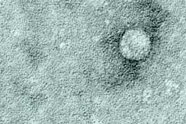 An image of hepatitis C