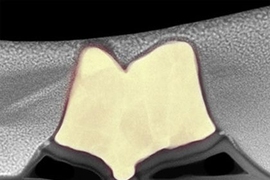 A cross-section of an experimental compound-semiconductor transistor developed by Jesus del Alamo's group at MIT's Microsystems Technology Laboratories.