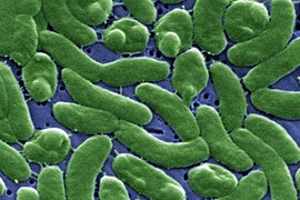 A scanning electron micrograph (SEM) of a grouping of Vibrio vulnificus bacteria.