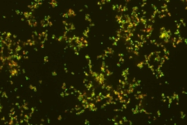 Nanoparticles, in green, targeting bacteria, shown in red.