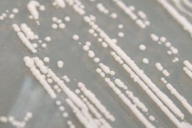 Yeast colonies shown close up.