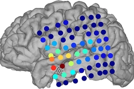 The colored dots in this image represent locations of the electrodes used to measure brain activity. As the brain wave oscillations become more asynchronous relative to the position of the star, the colors fade from red to blue.