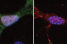 At left, a neuron exhibits normal DNA repair, indicated by green fluorescence. At right, a neuron with a mutated form of the FUS protein found in ALS patients shows very little DNA repair. 