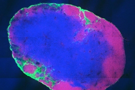 This cross section of a lymph node shows that the molecular
vaccine (green) has been taken up by immune cells in the lymph node.