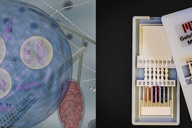 Left: Lipid nanoparticles (carrying siRNA) are shown as they are transported inside cells using endocytic vesicles. Right: Gehrke's lab is developing a diagnostic for Dengue virus, a relative to Zika. The device shown, which tested for Ebola, has silver nanoparticles of different colors that indicate different diseases. On the left is the unused device, opened to reveal the contents inside. On the...