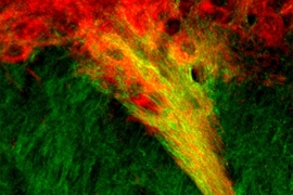 MIT neuroscientists have identified tight connections between dopamine-producing cells of the substantia nigra (red) and neurons in the striatum (green). These connections, which show up as yellow, may play a role in the brain’s decision-making processes.
