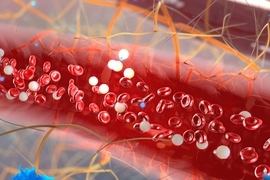 Engineers at MIT have devised a microfluidic technique to capture and count circulating plasma cells from small samples of blood. The technique, which relies on conventional blood draws, may provide patients with a less painful test for multiple myeloma. 
