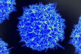 A scanning electron micrograph of a human T lymphocyte (also called a T-cell) from the immune system of a healthy donor. Researchers have designed a synthetic gene circuit that triggers the immune system to attack cancers when it detects signs of the disease. 
