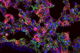 MIT researchers have designed nanoparticles that can deliver messenger RNA to specific organs. In this image, lung cells expressing the synthetic mRNA show up as red.
