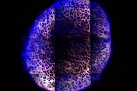 Six days after treatment with IGF-1 carried by dendrimer nanoparticles (blue), the particles have penetrated through the cartilage of the knee joint.