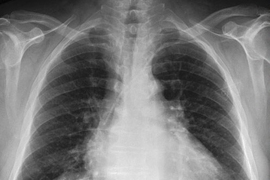 Researchers have released a repository of more than 350,000 detailed chest X-rays, which is free and open to academic, clinical, and industrial investigators.