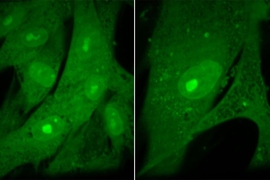 MIT researchers found that when they halted cell division in human fibroblast cells, they became abnormally large and then entered a non-dividing state known as senescence (right panel). Untreated, normal-sized fibroblasts are shown at left.