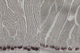 MIT biologists found that intestinal stem cell populations declined in aged mice (right), compared to younger mice (left). Messenger RNA encoding a protein associated with intestinal stem cells is labeled in black.