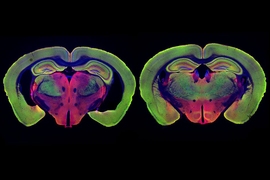 At left is the brain of a mouse genetically programmed to develop Alzheimer’s disease. At right, the brain of a mouse programmed to develop the disease, but treated with noninvasive visual stimulation, shows much less neurodegeneration.