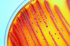 MIT researchers have shown that in microbial communities, bacterial species with a small population size under normal conditions can increase in abundance as environmental conditions deteriorate.