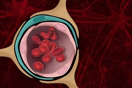 The blood-brain barrier — the normally tight border that prevents harmful molecules in the bloodstream from entering the brain — can be damaged by the protein aggregates that form in the brains of Alzheimer’s patients.