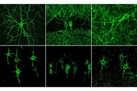 In the top row, neurons are labeled with a fluorescent probe that reveals electrical activity. In the bottom row, neurons are labeled with a variant of the probe that accumulates specifically in the neuron cell bodies, preventing interference from axons of neighboring neurons. 