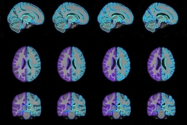 With their model, researchers were able to generate on-demand brain scan templates of various ages (pictured) that can be used in medical-image analysis to guide disease diagnosis. 