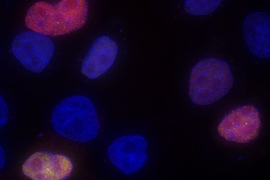Cells transfected with fluorescent genes have different colors depending on their splicing patterns. 