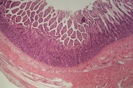 MIT engineers have devised a new approach to studying complex diseases such as ulcerative colitis, which causes inflammation of the intestines.