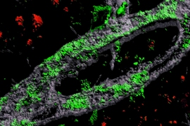 In Alzheimer's disease, the blood-brain barrier can become disrupted by the accumulation of amyloid protein, especially in people who carry a genetic variant called APOE4. This 3D rendering of an APOE4-carrying engineered blood vessel shows heavy accumulation of amyloid protein (green).