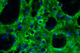 Researchers are studying the role of the immune system molecule IL-6 in Huntington's disease, which leads to neurodegeneration in a region of the brain called the striatum. In this figure from a prior study, green staining highlights Stat3 in the striatum. Stat3 is a major transducer of IL-6 signaling.