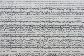 Dark, wavy lines representing brain cell activity stretch across a gray page.