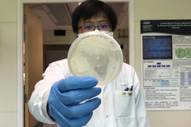 Researcher holding a petri dish