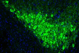 Image of a glowing green clump of cells in a teardrop shape