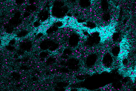 Model of a brain scan with fibers that seem to have holes in them. Fibers are cyan, while small dots are magenta.