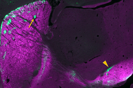 Microscope image of neurons, shaded mostly in purple, with small clusters of green and a small yellow arrow pointing to one green cluster in particular