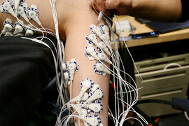 better prosthetics