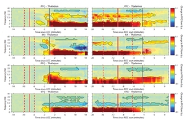 Eight horizontal images shows stripes of color moving across over a horizontal axis of time and a vertical axis of frequency.