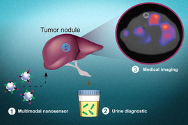 nanosensors detecting tumor microenvironment