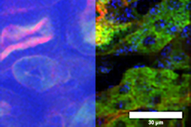 temporal focusing microscopy