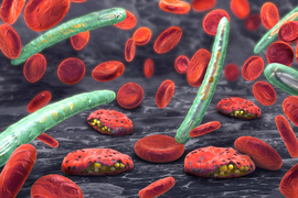 Plasmodium falciparum
