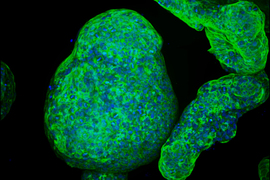 synthetic gel in cell