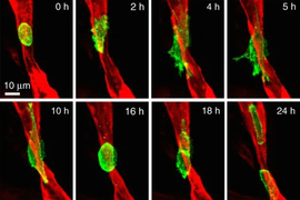 Two by four grid of images featuring a micrograph of a red tube. In each, there is a green blob or blobs indicating the presence of a tumor cell or cells