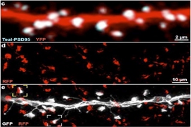Three vertically stacked horizontal panels. The top shows a long thick red srip with white dots along its length. The seond shows red splotches. The third shows the red splotches overlaid on a spiny white strip. Two areas where the red and white collide are boxed.