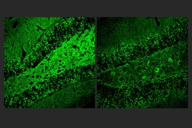 Two square panels side by side show similar swaths of brain tissue stained green on a black background. The left side is much brighter than the right.