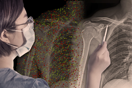 Medical technician looking at an X-ray with the help of an AI assistant