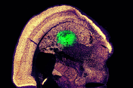Scan of brain, with a circle of green neurons