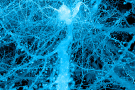 Microscopic image of a network of neurons 