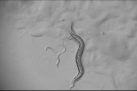 A grayscale photomicrograph of a squiggly worm against a lumpy background